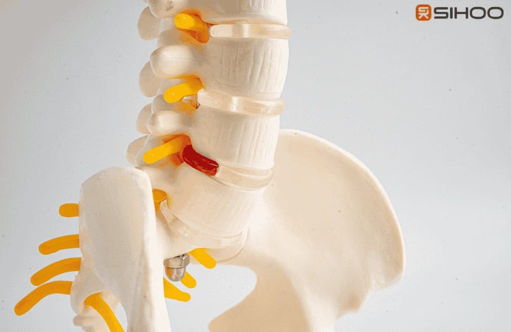 Modèle anatomique de la colonne vertébrale et du coccyx illustrant l’origine mécanique des douleurs et la pression sur les disques en position assise
